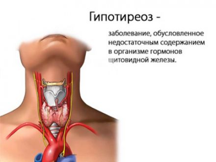 Как часто гипотиреоз встречается у жителей Республики Беларусь?